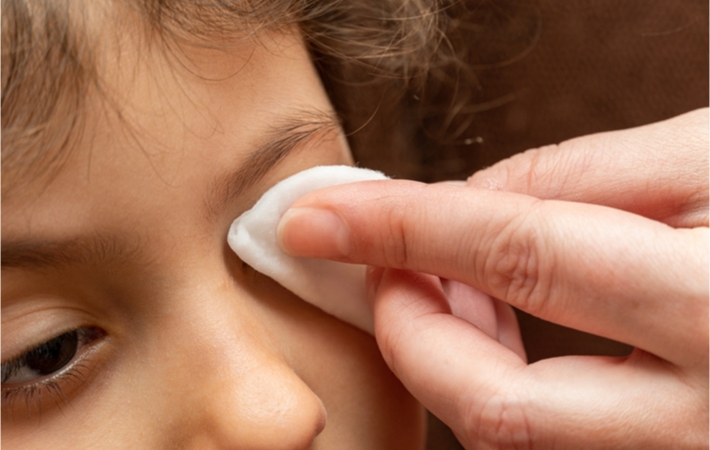 Close up image of an adult hand helping to wipe the left eye of a child with a cotton swab.