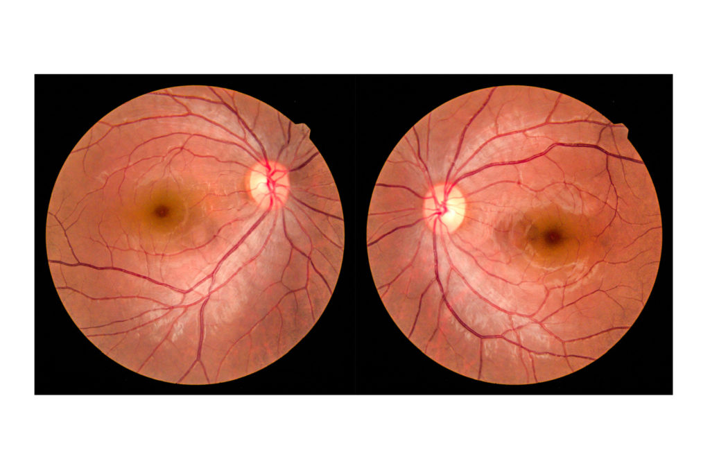 Imaging of two retinas.